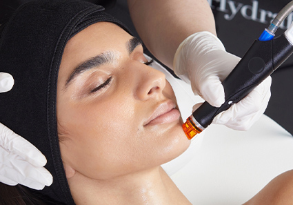 HydraFacial at BeyondSkin MedSpa