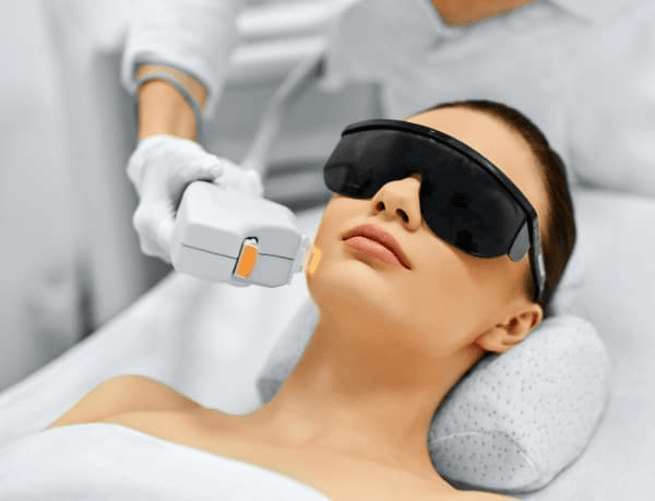 Treating Acne with IPL, What to Expect?